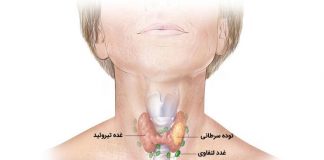 سرطان تیروئید قابل درمان است ؟ ندول تیروئید- متخصص غدد